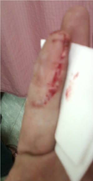 Name: damnfinger.jpg
Views: 26
Size: 15.8 KB