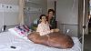Vietnam surgery removes tumor twice man's weight-120106045410-nguyen-duy-hai-tumor-story-top.jpg